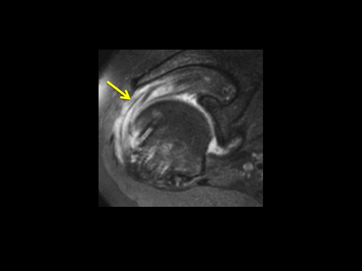 Figure 5 for case fixation device ( RID5471 )
